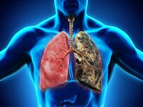توصیه‌هایی برای مقابله با بیماری آسم