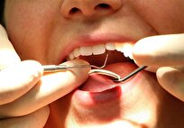 ارتباط بیماری‌های دهان و دندان با بروز بیماری‌های قلبی